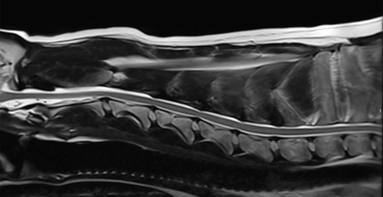 FX3 MRI